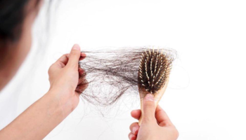 Sức khỏe đường ruột kém thầm lặng gây rụng tóc ít ai ngờ 